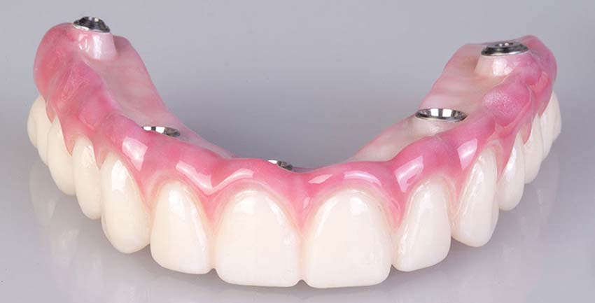 Troque sua dentadura pela protocolo!