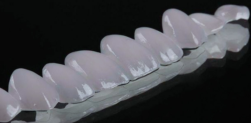 Lentes de contato dental
