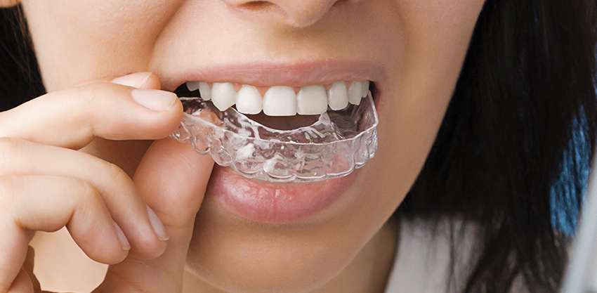 Você com sorriso perfeito de forma discreta